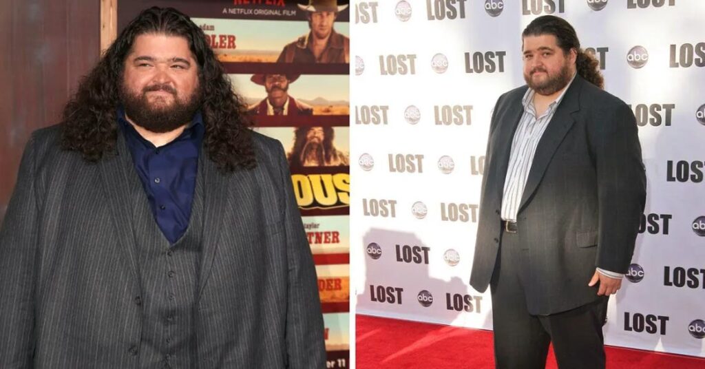 Jorge Garcia before and after 